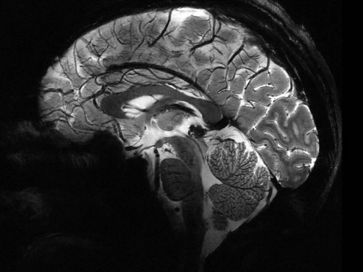 Самый мощный аппарат МРТ сделал первые снимки мозга - 4PDA